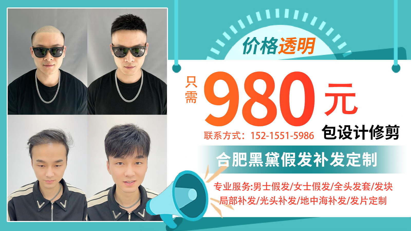 2026年优质的地中海假发补发、超透气假发套怎么选指南：聚焦五大品牌差异化优势与数据驱动的选购策略